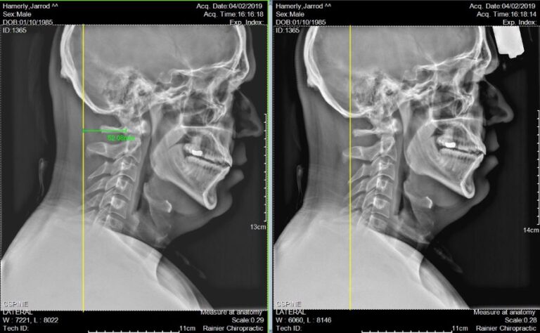 qvi9RlqCuf93VIstEXHt0CgaTW4daLh6A3bcgSOQ 768x474