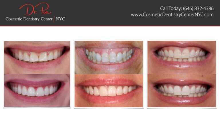 additional photo 4 768x432